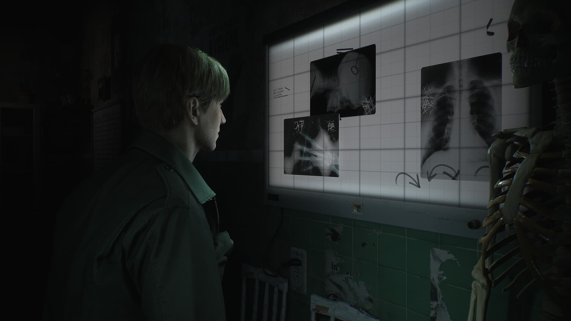 Silent Hill 2 thumbnail 7